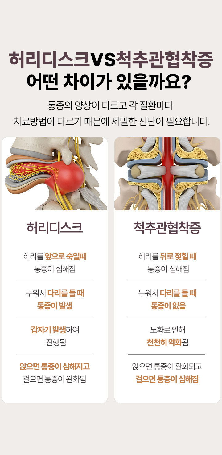 허리디스크와 척추관협착증 어떤 차이가 있을까요? 통증의 양상이 다르고 각 질환ㄴ마다 치료방법이 다르기 떄문에 세밀한 진단이 필요합니다.