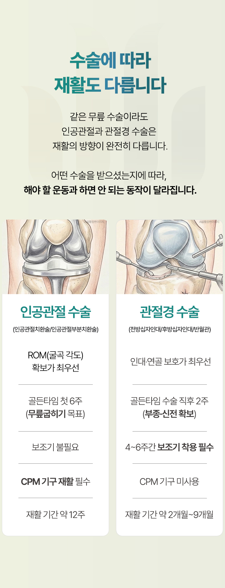 수술에 따라 재활도 다릅니다. 같은 무릎 수술이라도 인공관절과 관절경 수술은 재활의 방향이 완전히 다릅니다.