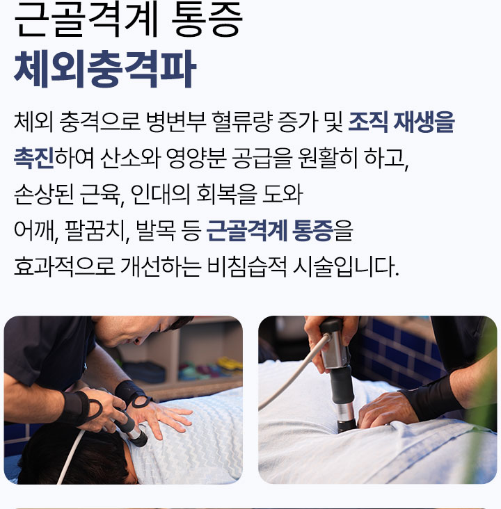근골격계 통증 체외충격파, 체외 충격으로 조직 재생을 촉진하여 근골격계 통증을 개선하는 비침습적 시술