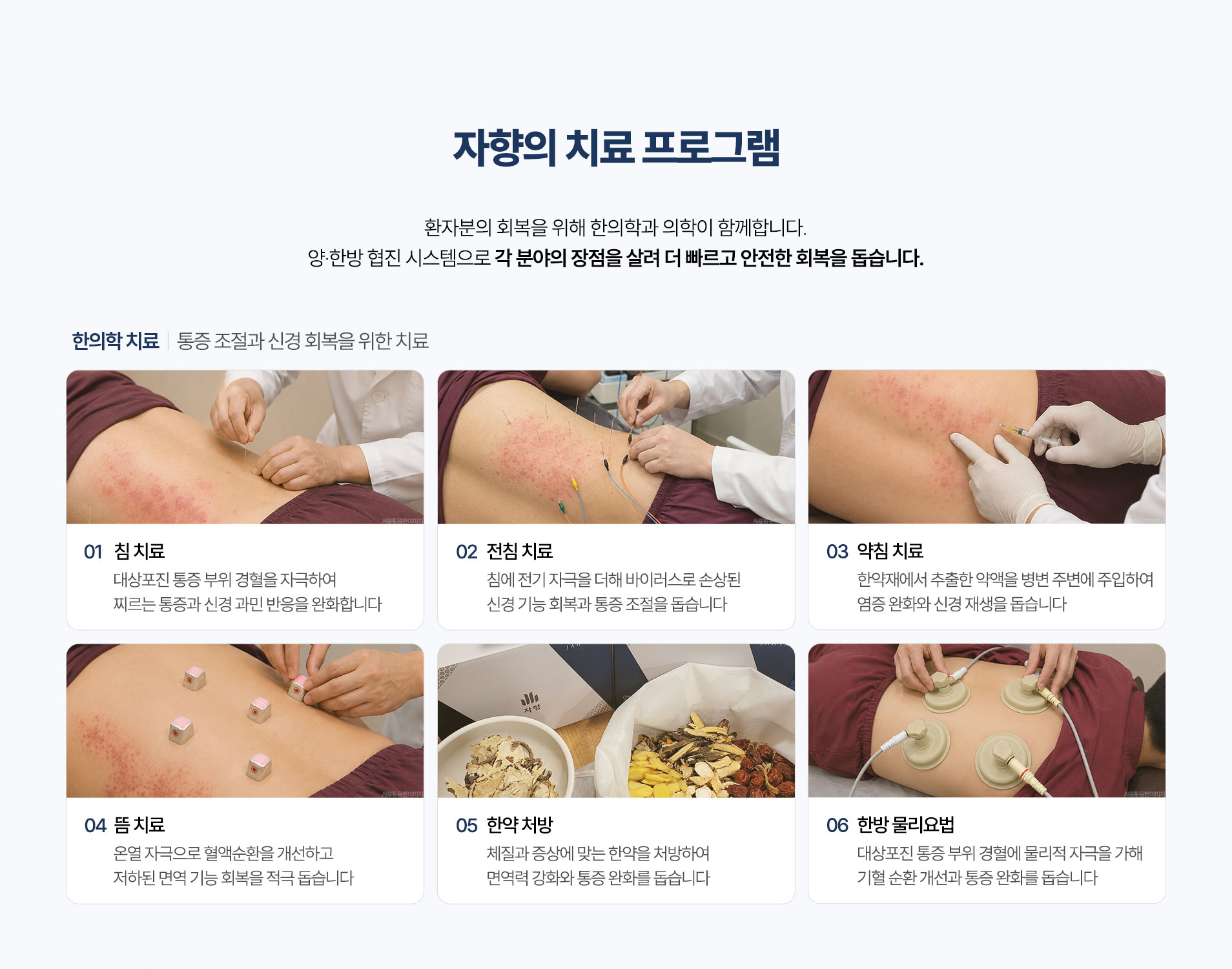 한의학 치료 구성. 침 치료, 전침 치료, 약침 치료, 뜸 치료, 한약 처방, 한방 물리요법